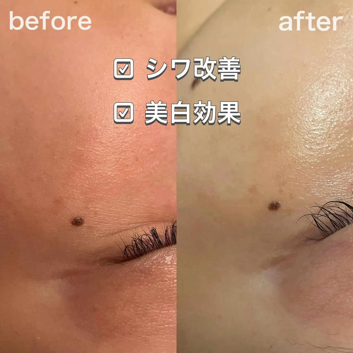 目の下のシワ改善👀✨