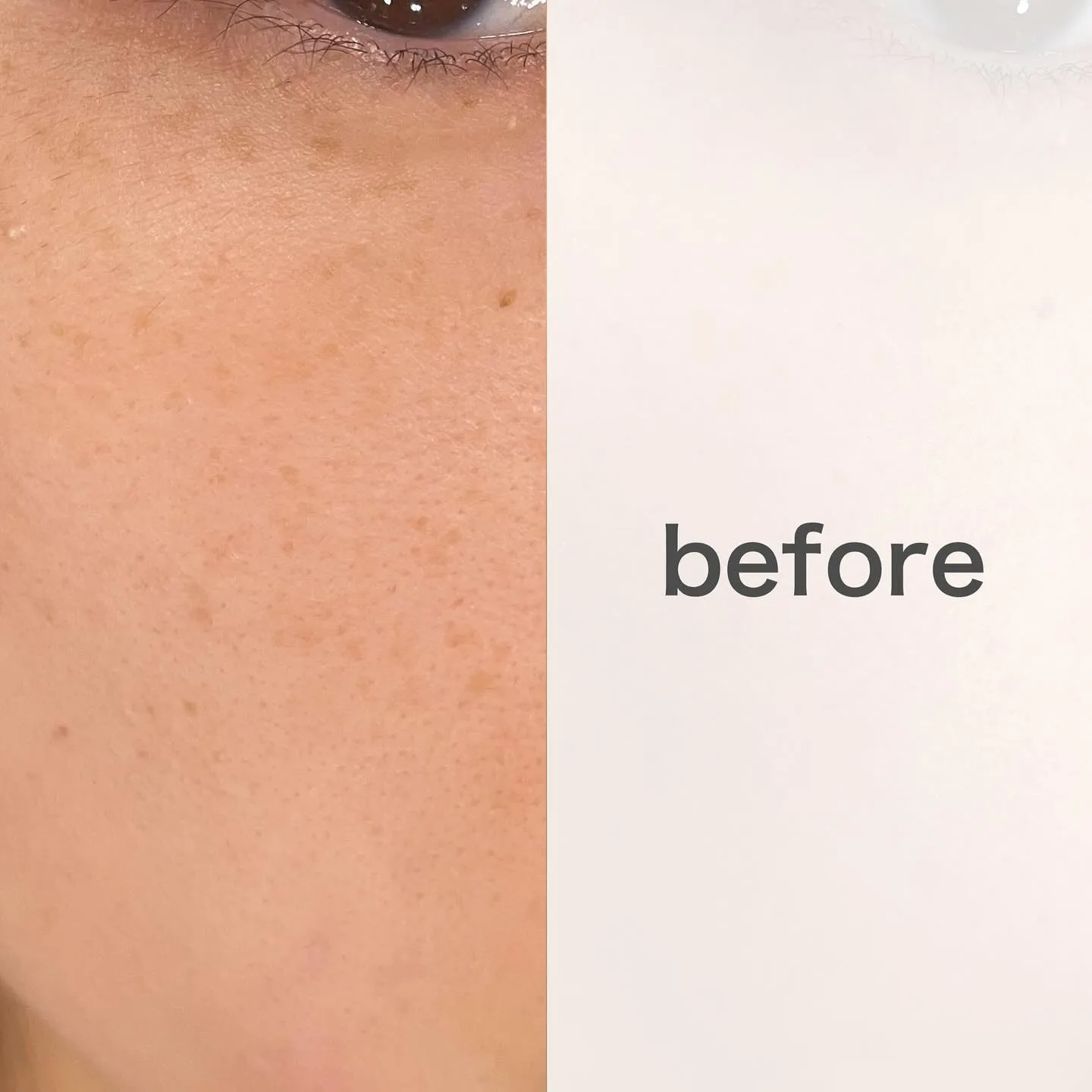 シミ・そばかす、毛穴開き改善！🌸