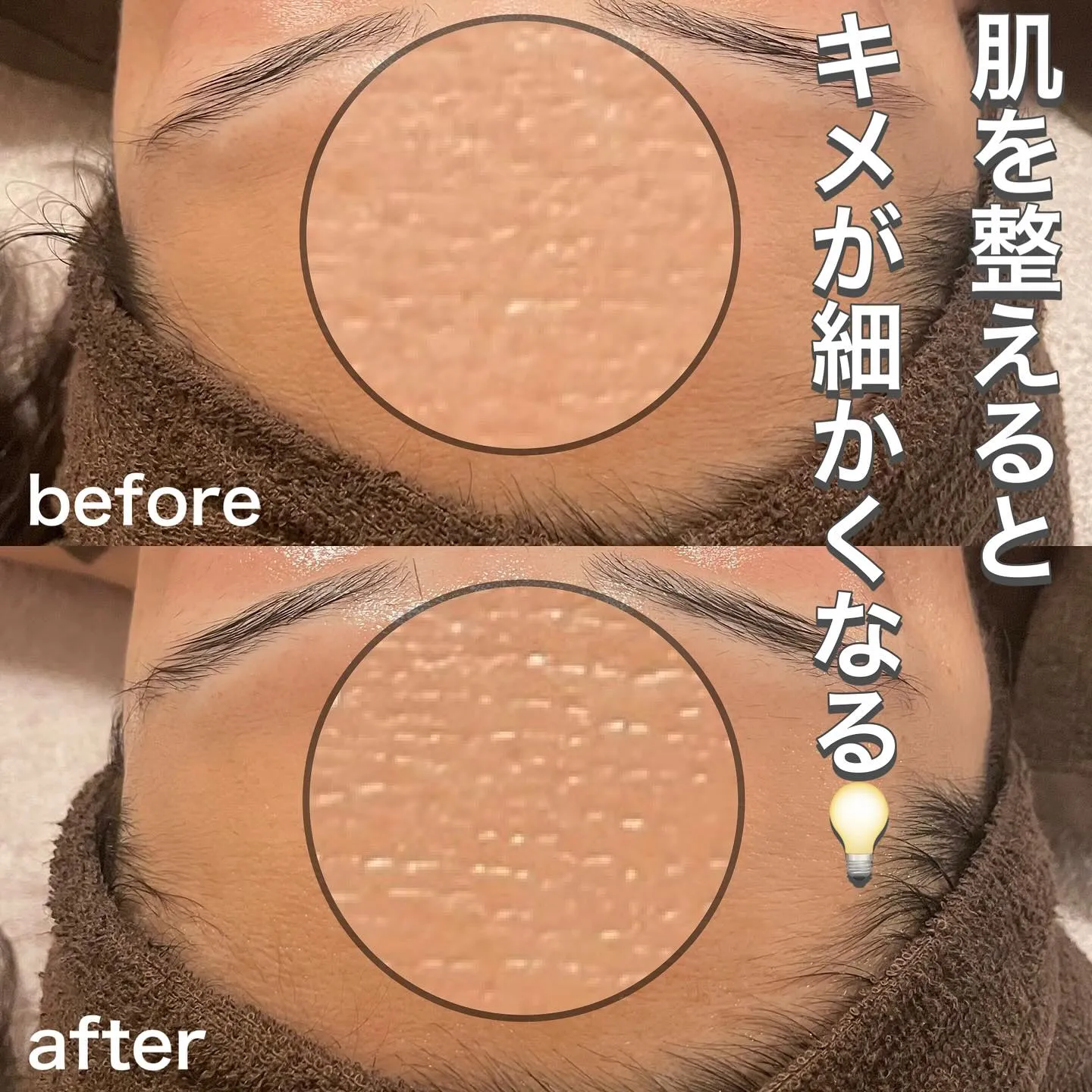 キメが細かいと、毛穴が目立たず若々しい印象に💡