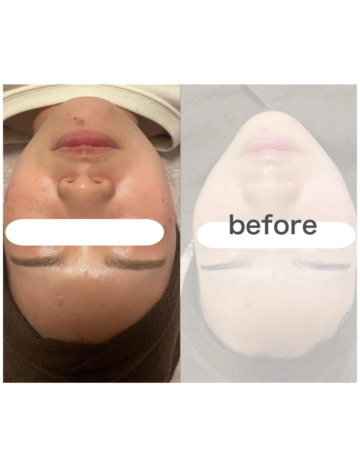 とんでもないビフォーアフター🤣😳✨