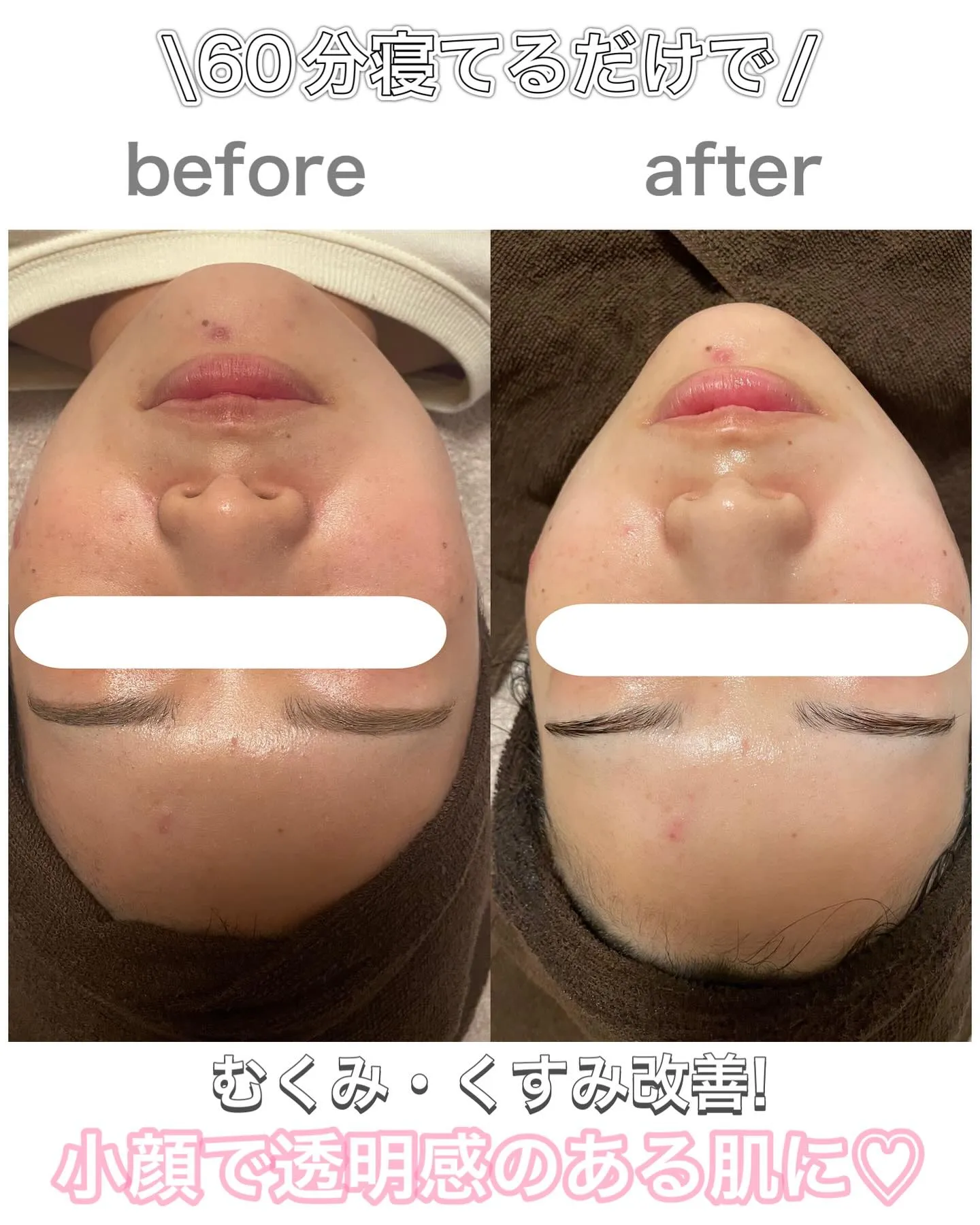 とんでもないビフォーアフター🤣😳✨