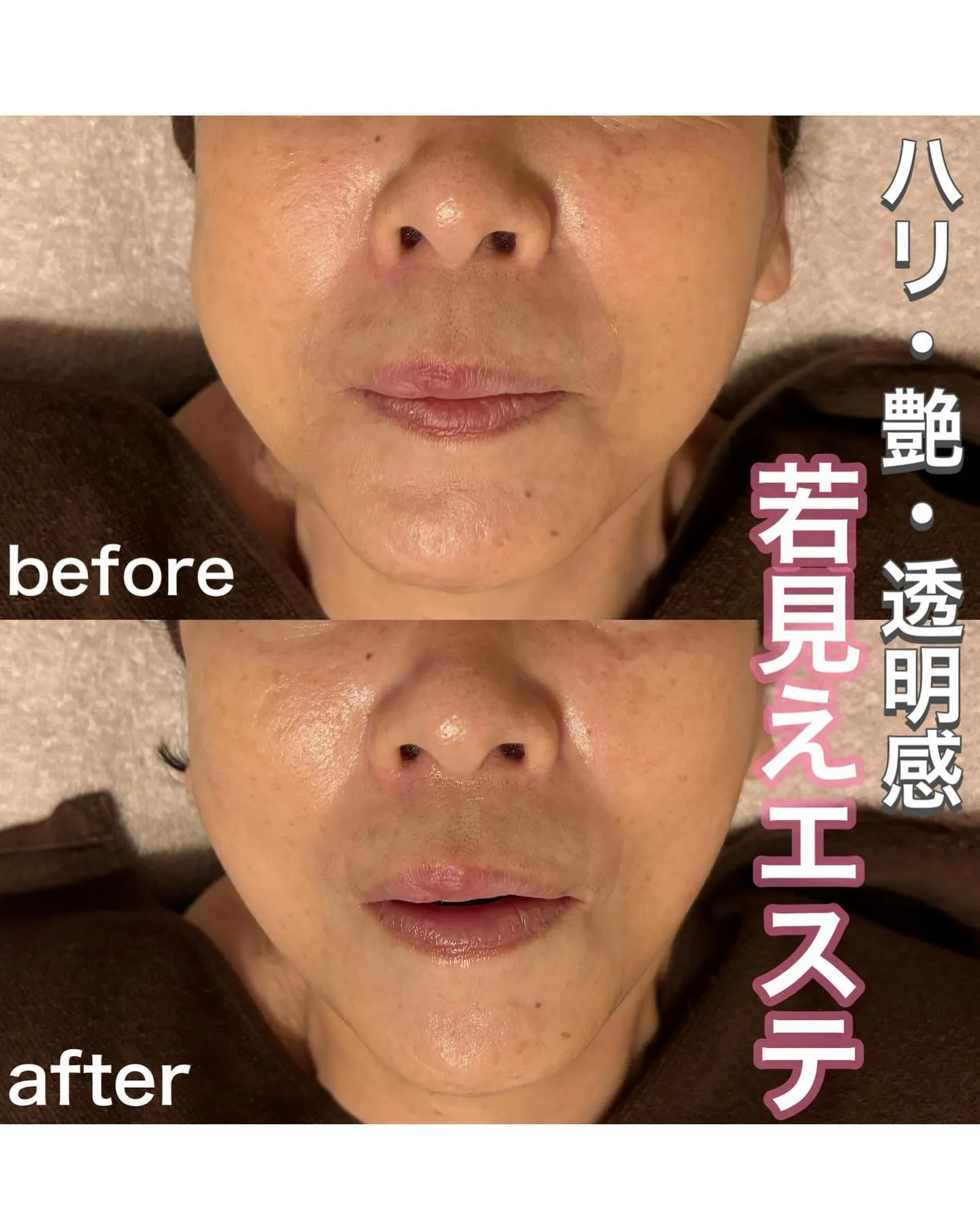 若見え👀✨お肌の細胞から若々しくするフェイシャルエステ💆‍♀...