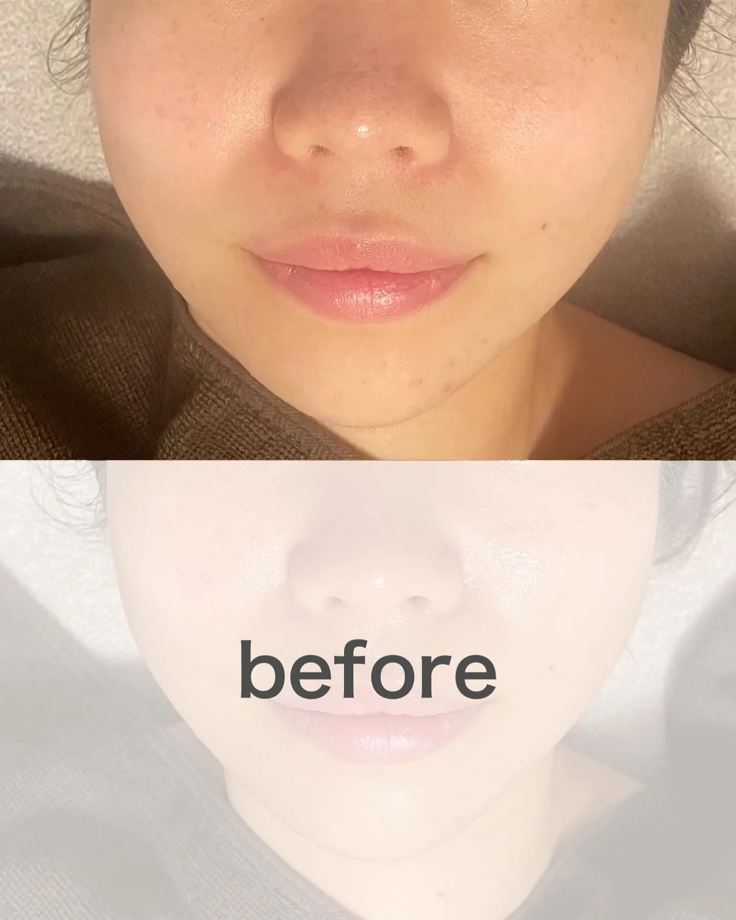 くすみ肌改善👀透明感ある肌に🤍✨