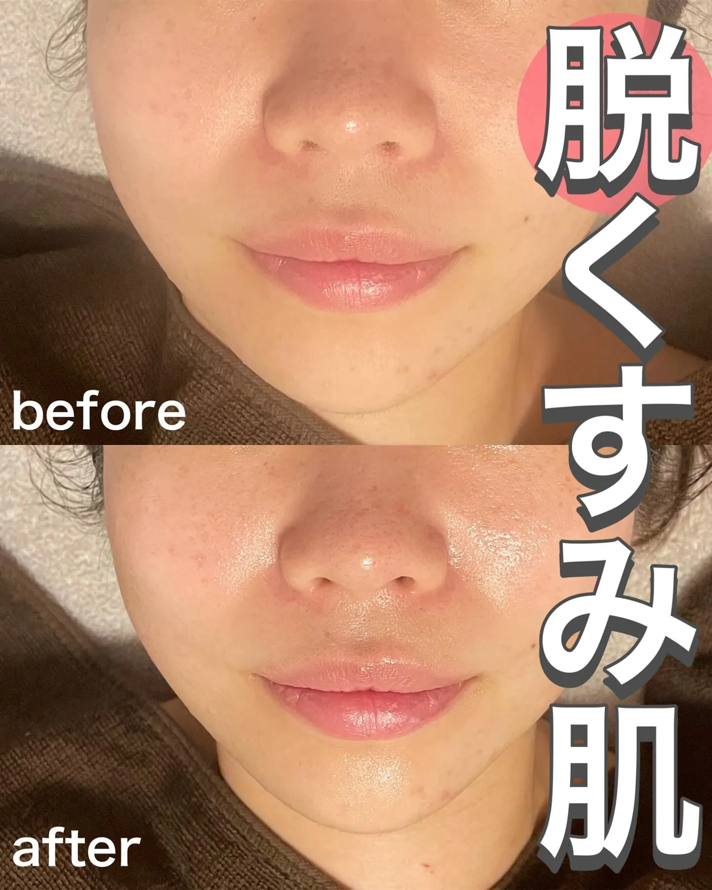 くすみ肌改善👀透明感ある肌に🤍✨