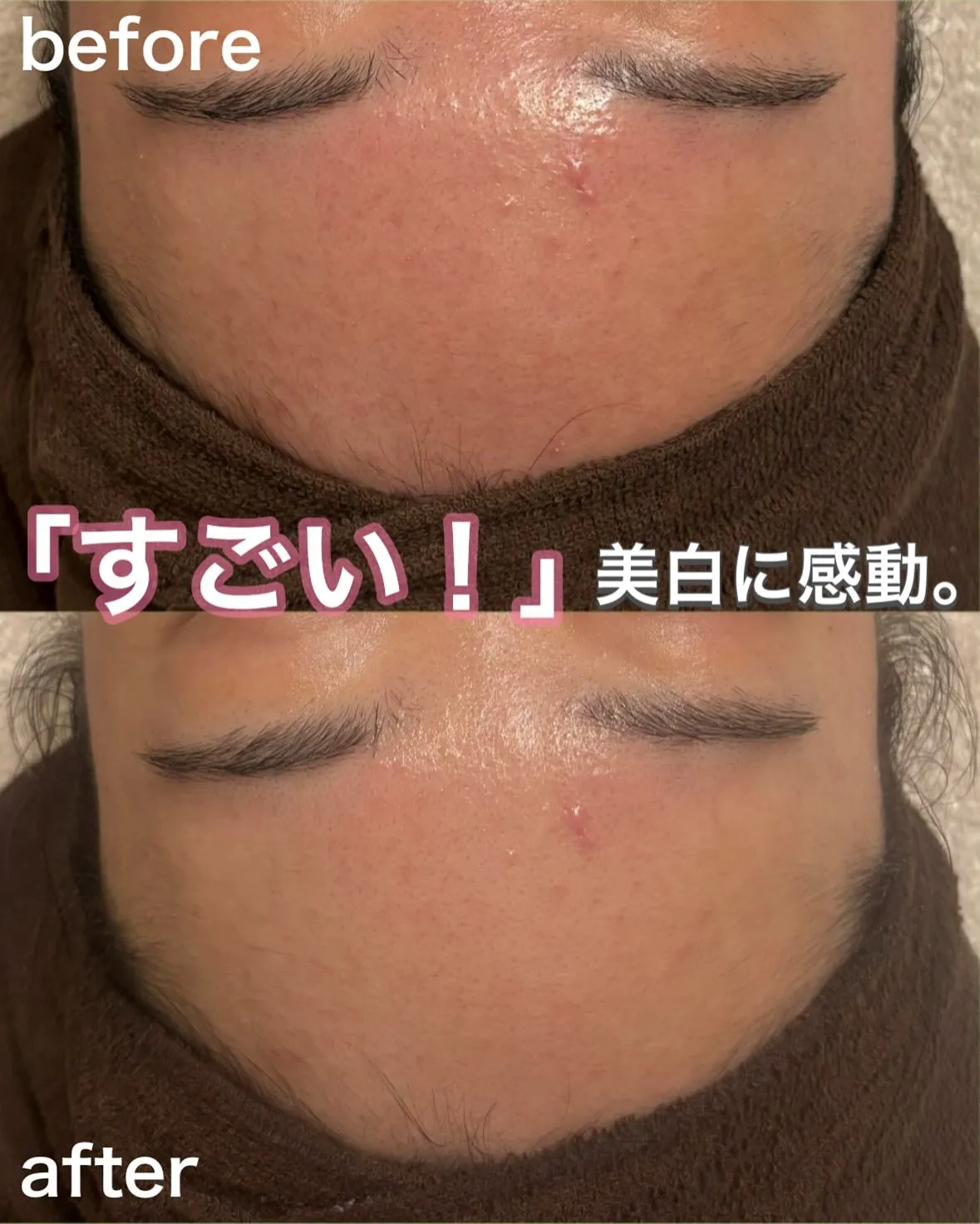 「綺麗になりたい」を叶えます💐美白が得意なフェイシャルエステ...