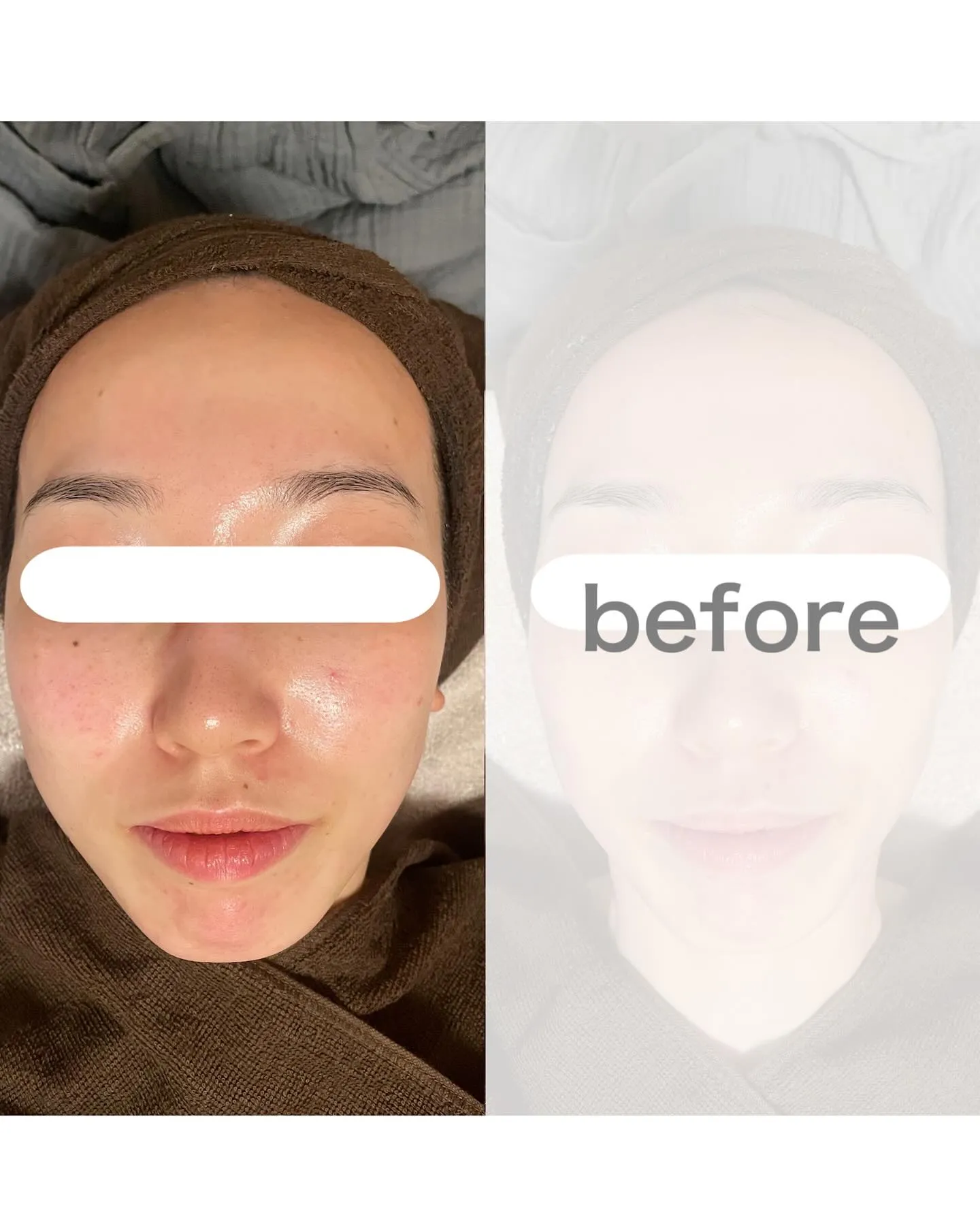 プライベートサロンの小顔エステ💆‍♀️💐