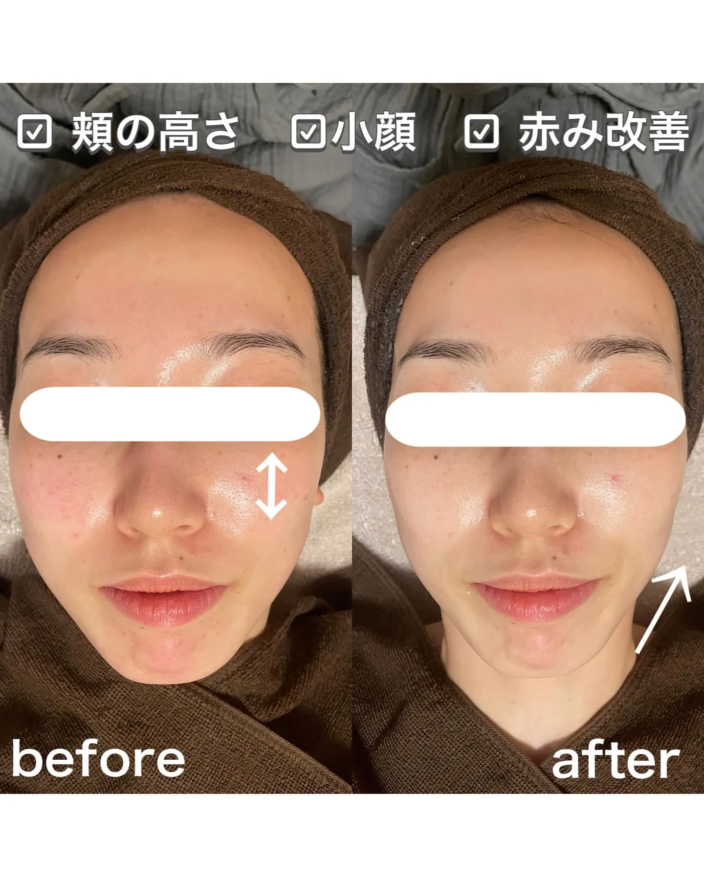 プライベートサロンの小顔エステ💆‍♀️💐