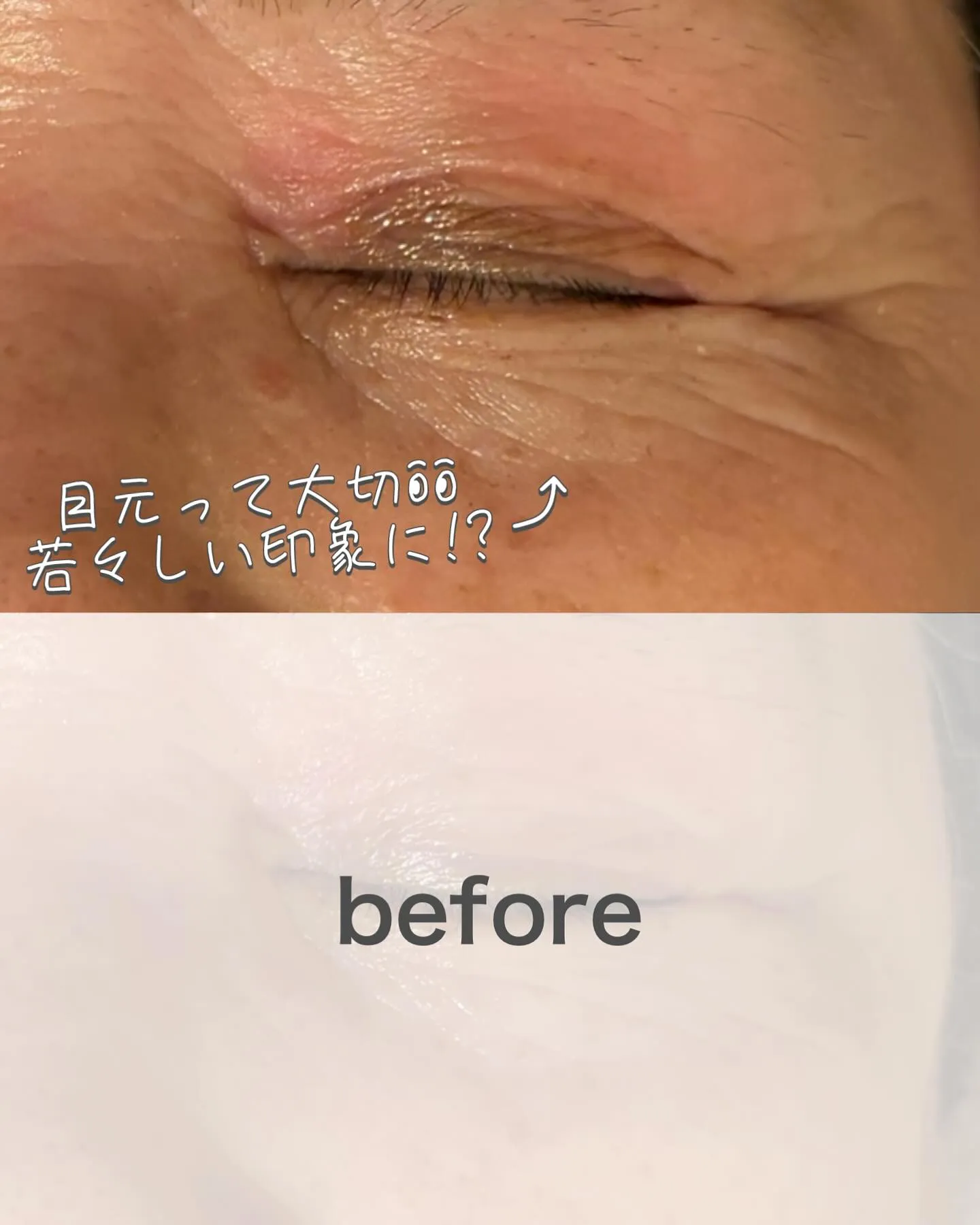 たった1回で👀ビフォーアフターにびっくり！浅草橋のフェイシャ...