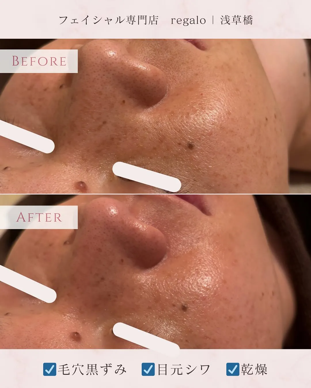 ✨Before → After✨