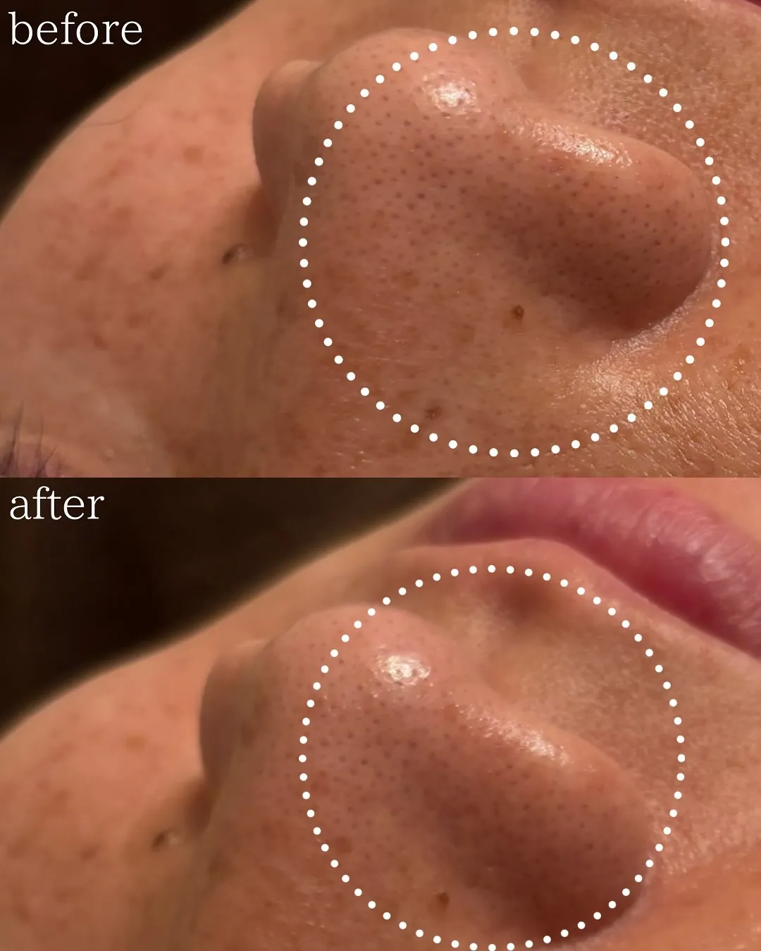 ✨Before → After✨