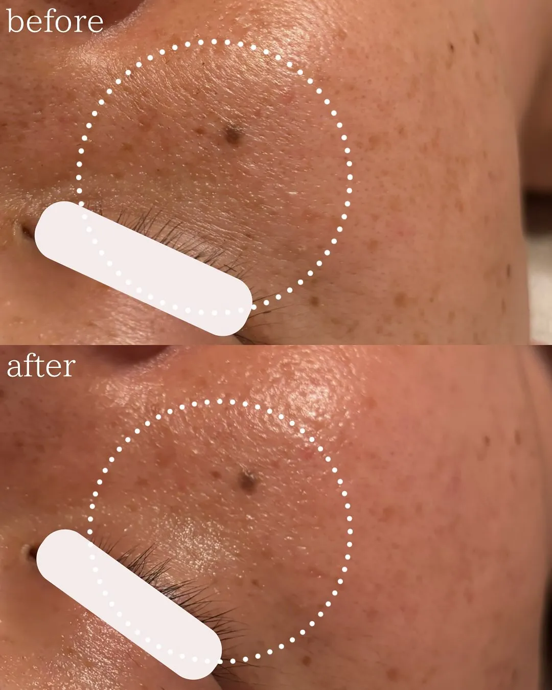 ✨Before → After✨