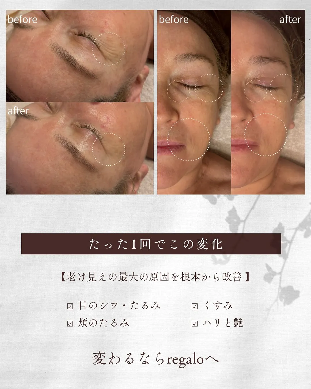 浅草橋の若見えフェイシャル専門店regalo🌸