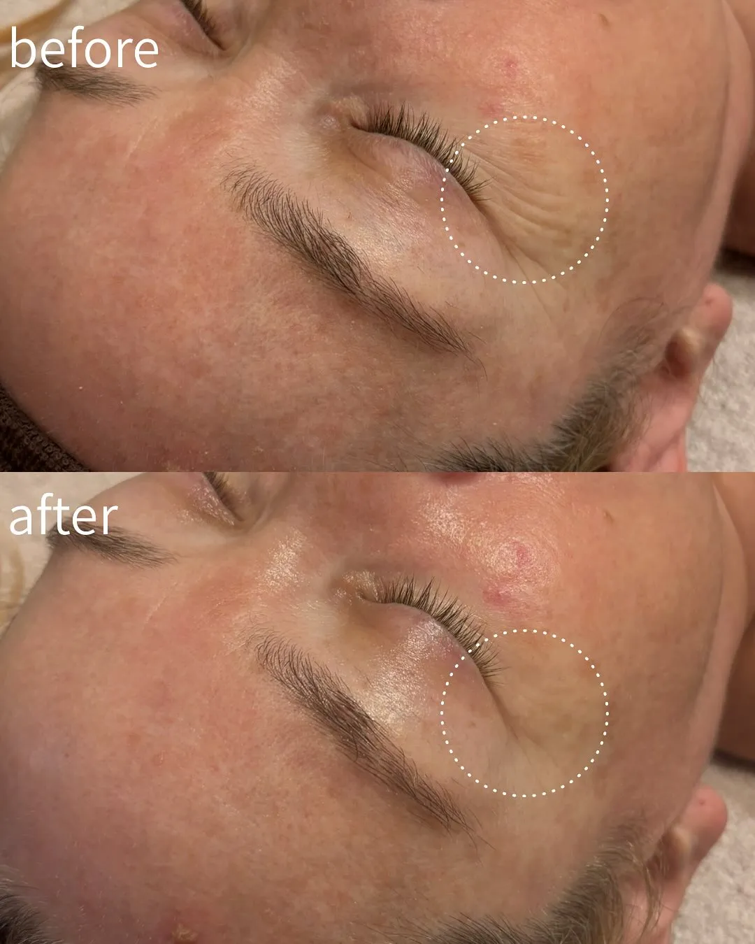 たった1度で!? 目のシワすっきり〜♡