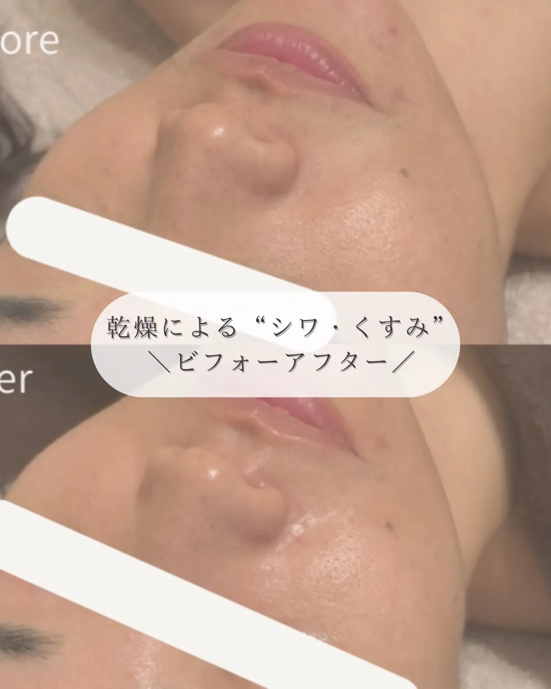 30代/乾燥/小ジワ/くすみ...