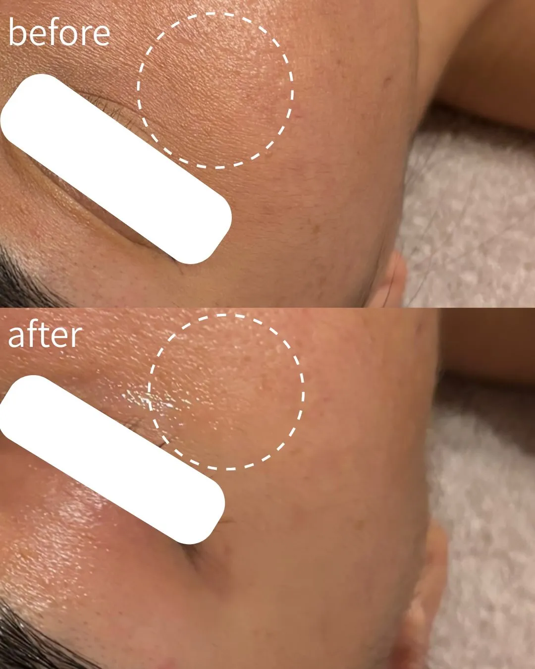 30代/乾燥/小ジワ/くすみ...