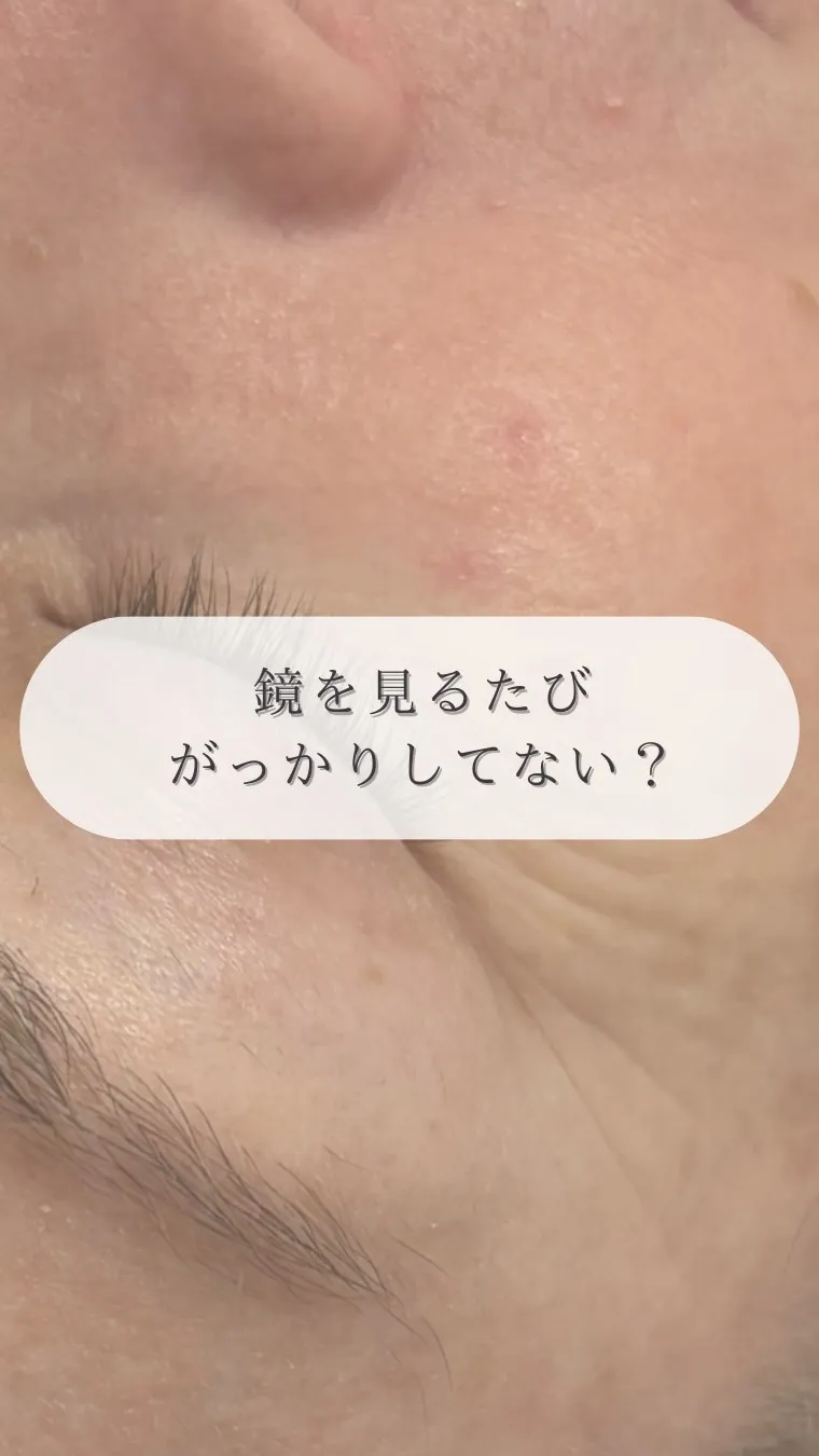 シワの原因、加齢だけじゃないって知ってる？😳✨